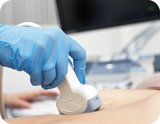 Допплерография сосудов